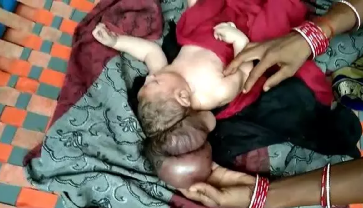 Bebê-Bebê de três cabeça