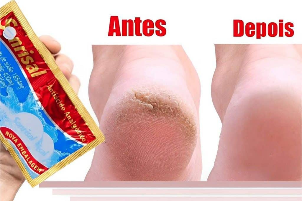 Como Hidratar Pés Rachados