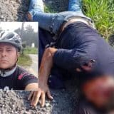 Diretor De Obras Da Prefeitura De Mairinque Sofre Grave Acidente De Bicicleta E É Socorrido Com Urgência