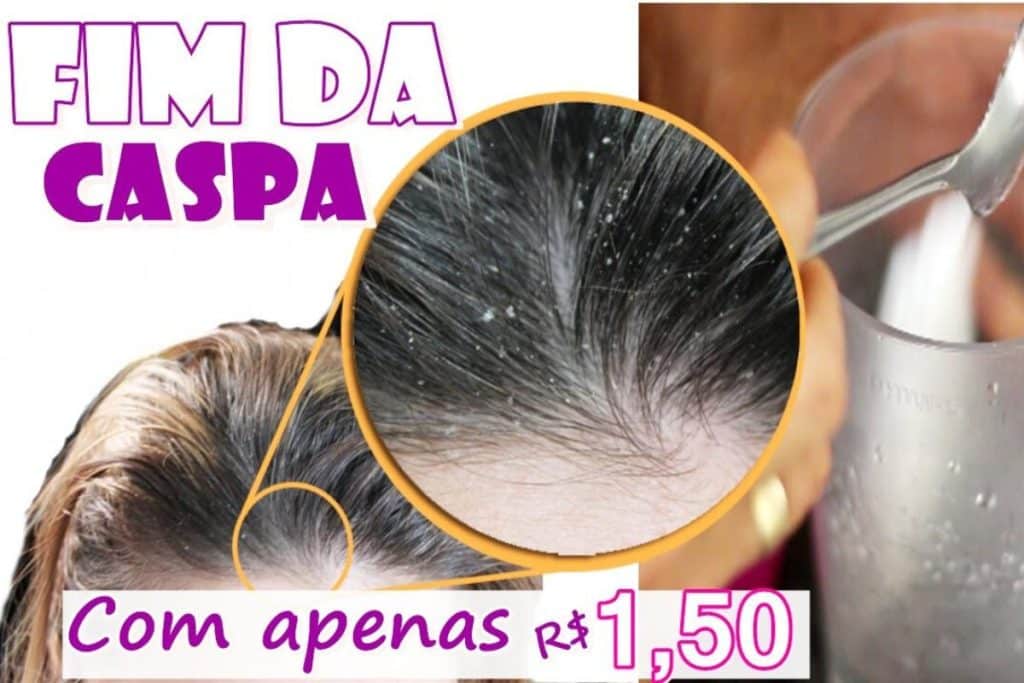 Como Acabar Com As Caspas