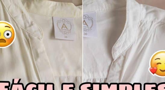 Tirar Amarelado De Roupa Branca