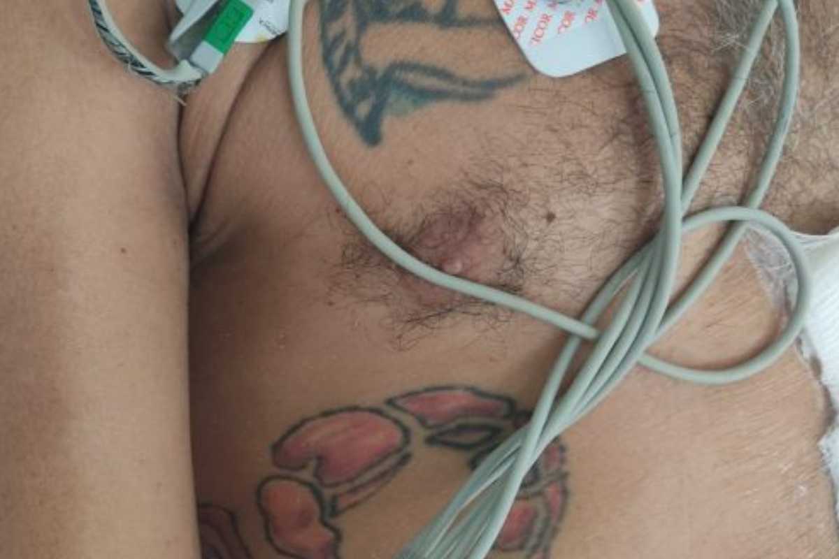 Santa Casa De São Carlos Pede Ajuda Para Identificar Homem Que Chegou Ao Hospital Após Espancamento