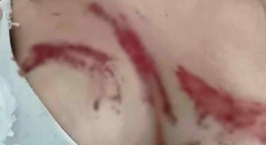 Jovem Toma Água De Desconhecido E Acorda Machucada Em Matagal Em Sorocaba