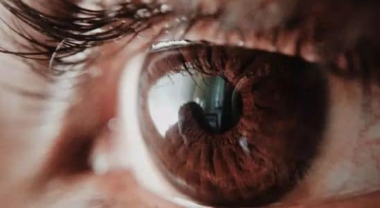 Oftalmologista Alerta Para Os Cuidados Com Os Olhos Em Meio Ao Calor Intenso No Interior De Sp