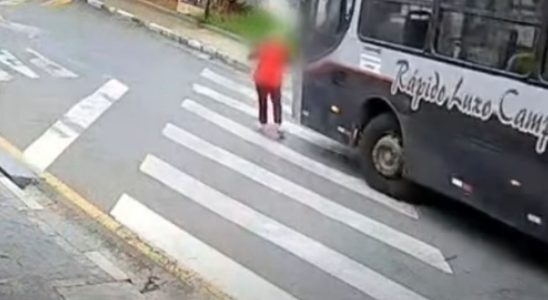 Idosa Amputa As Duas Penas Ao Ser Atropelada Por Ônibus No Interior De Sp 2 Idosa Amputa As Duas Penas Ao Ser Atropelada Por Ônibus No Interior De Sp