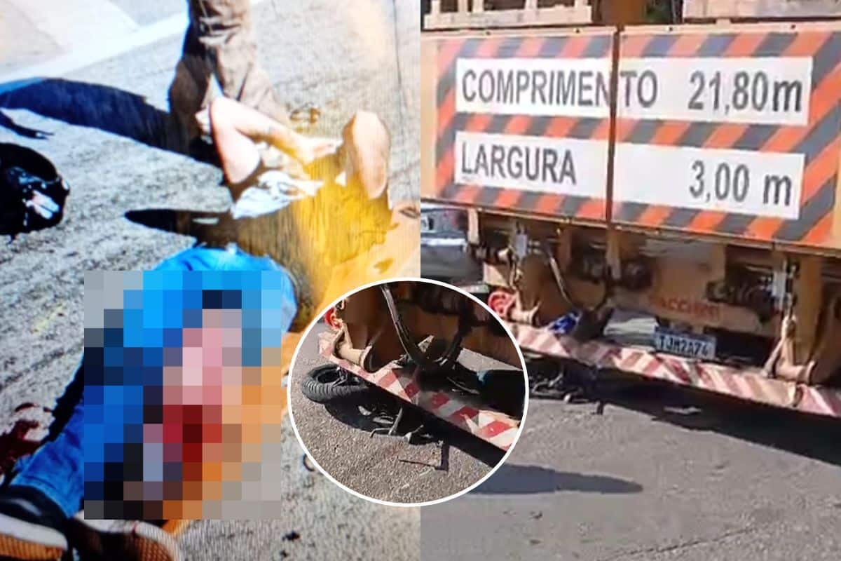 Jovem Teve Parte Da Perna Decepa