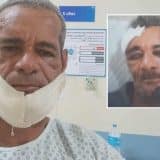 Homem Atacado Com Barra De Ferro No Rosto Após Sair De Bar Em Mairinque Deixa Hospital