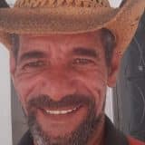 Morador De Mairinque Atacado Com Barra De Ferro No Rosto Passa Por Cirurgias