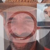 Morador De Mairinque Fica Gravemente Ferido Ao Ser Atacado Com Barra De Ferro Ao Sair De Bar