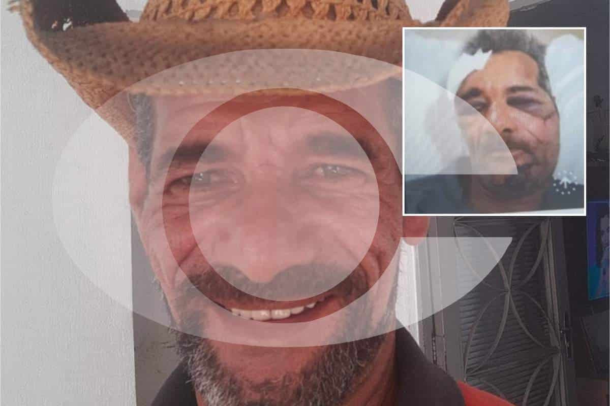 Morador De Mairinque Fica Gravemente Ferido Ao Ser Atacado Com Barra De Ferro Ao Sair De Bar