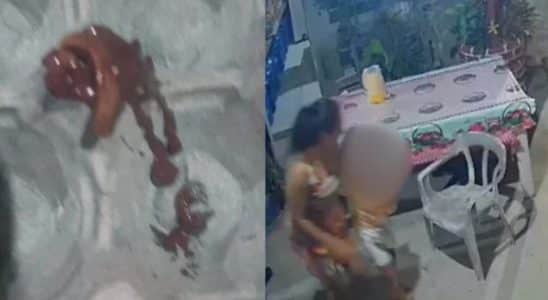 Crianca Passa Mal Apos Consumir Acai Com Lesma