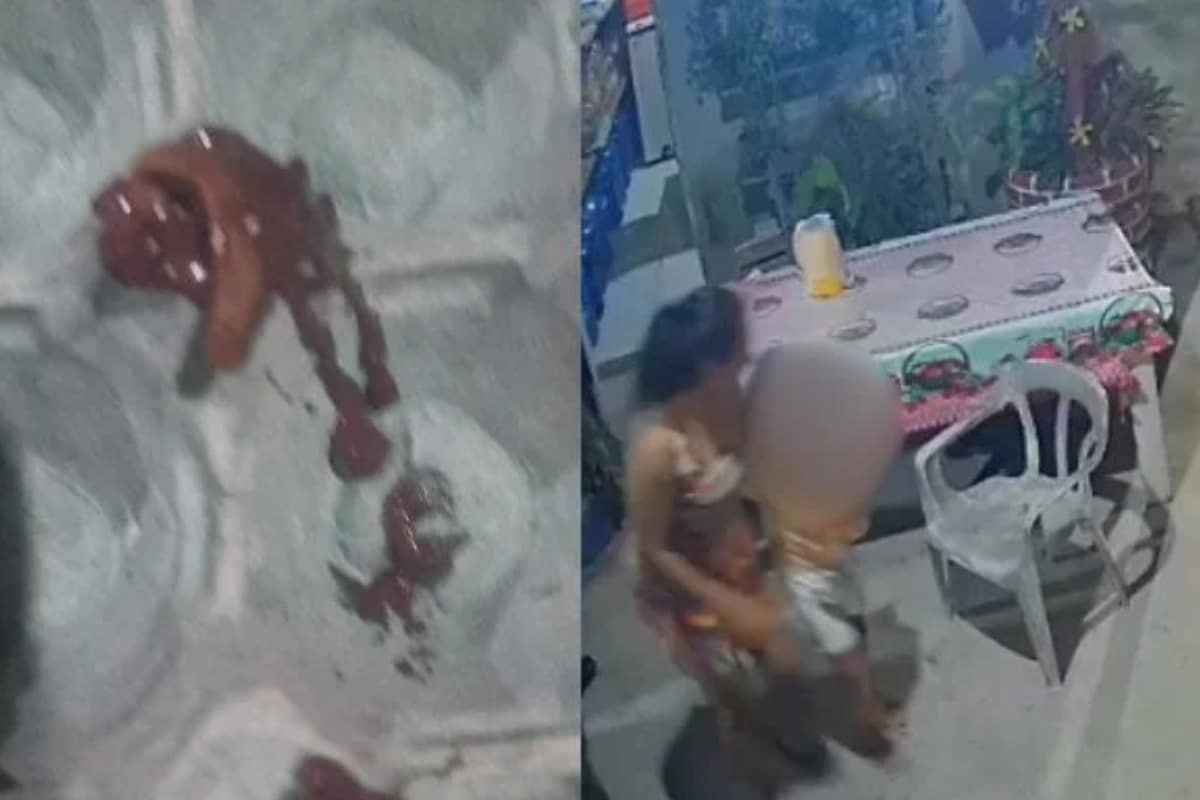 Crianca Passa Mal Apos Consumir Acai Com Lesma