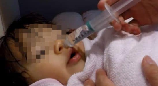 Erro Médico Em Dois Córregos Bebê Recebe Álcool Durante Lavagem Nasal