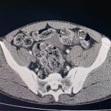 Bolivianos Detidos Com Cocana Drama Na Rodovia Cas 1769269613280