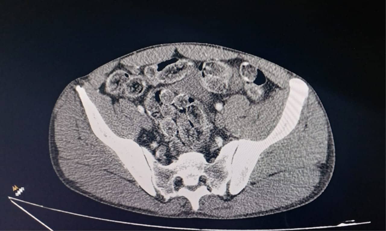 Bolivianos Detidos Com Cocana Drama Na Rodovia Cas 1769269613280