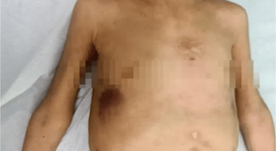 Avô Confessa Que Agredia Neta Que Levou Morta Em Upa Em Ribeirão Preto