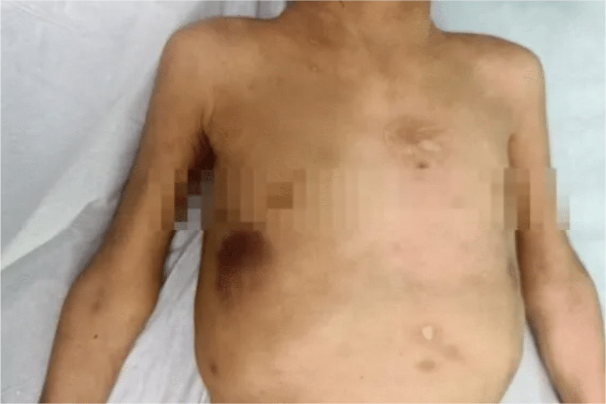 Avô Confessa Que Agredia Neta Que Levou Morta Em Upa Em Ribeirão Preto