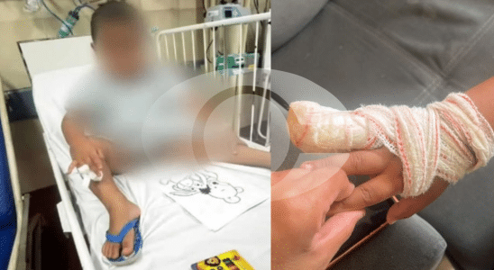 Incidente Em Creche De Sorocaba Faz Criança Amputar Dedo