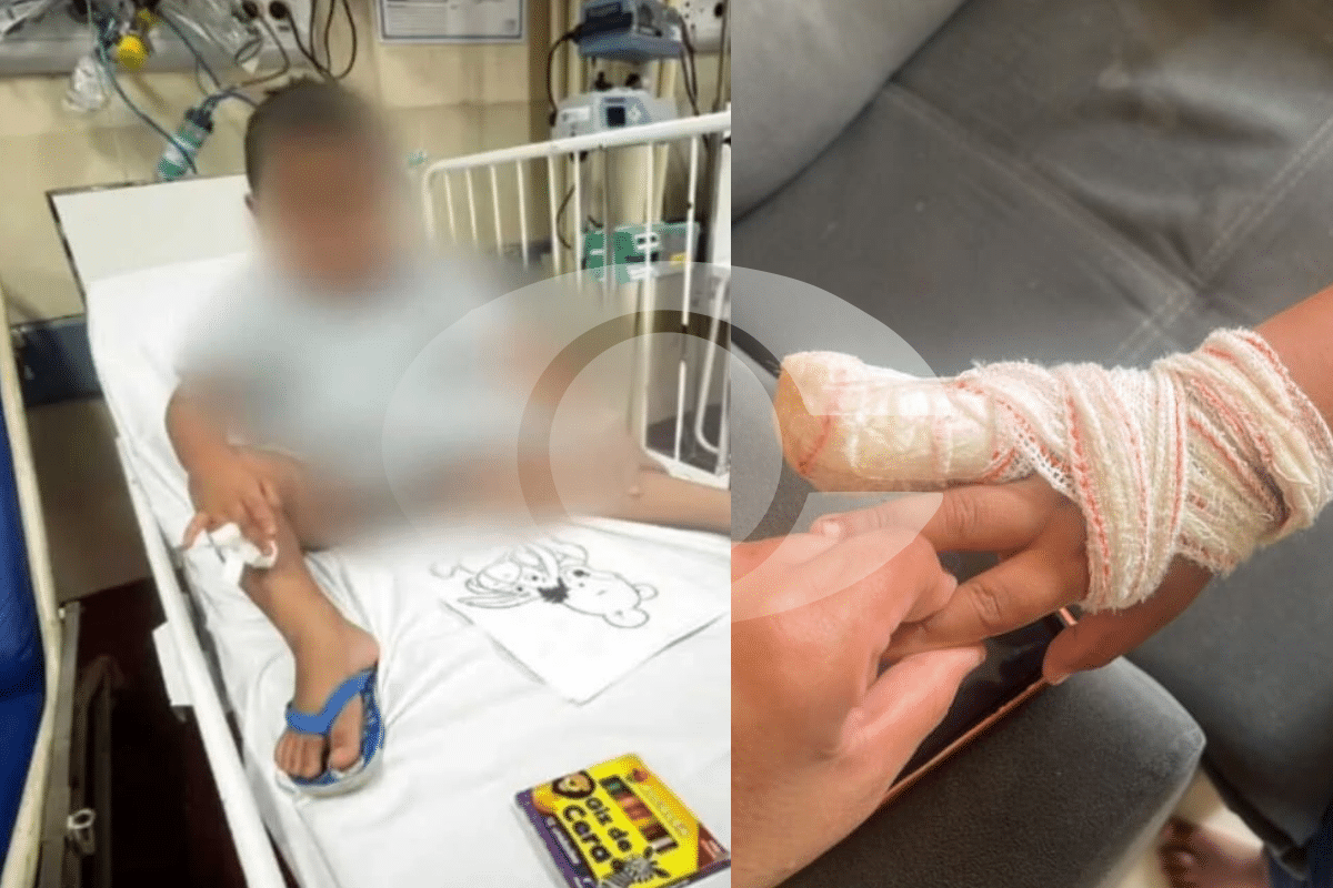 Incidente Em Creche De Sorocaba Faz Criança Amputar Dedo