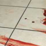 Mulher Surta Em Empresa Em São Roque, Se Corta E Diz Que Vai Passar Aids Para Colegas