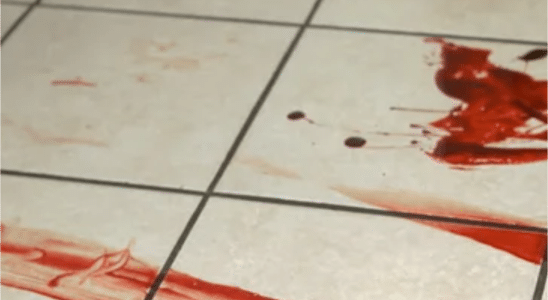 Mulher Surta Em Empresa Em São Roque, Se Corta E Diz Que Vai Passar Aids Para Colegas