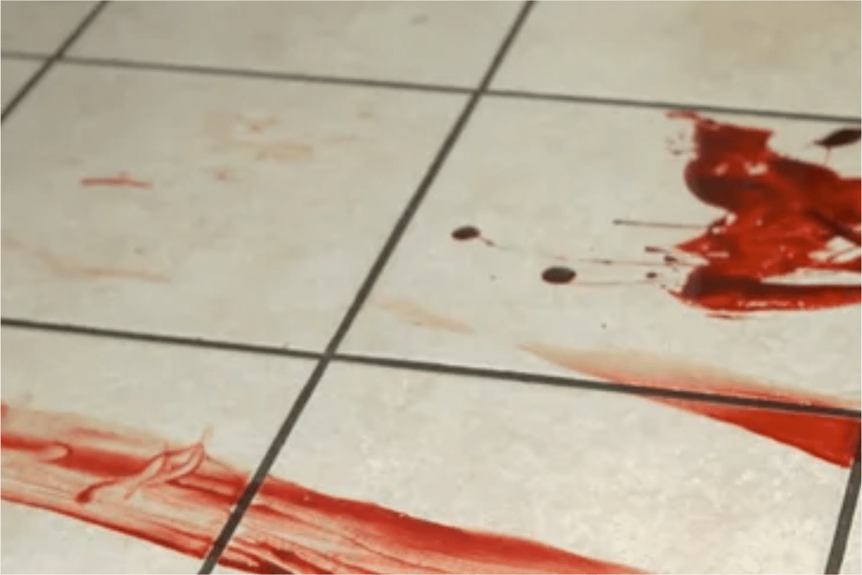 Mulher Surta Em Empresa Em São Roque, Se Corta E Diz Que Vai Passar Aids Para Colegas