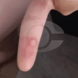 Professora É Acusada De Queimar Aluno Com Cola Quente Por Pedir Para Ir Ao Banheiro