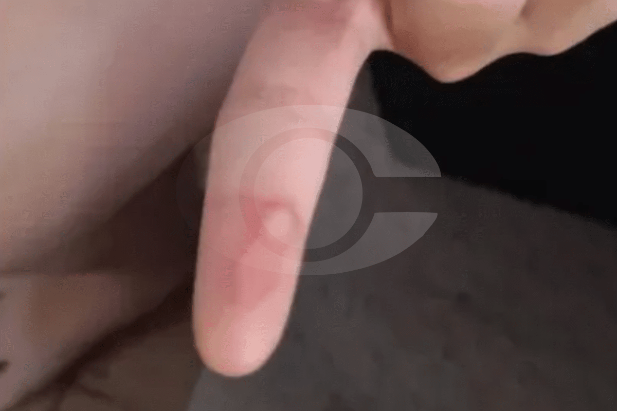 Professora É Acusada De Queimar Aluno Com Cola Quente Por Pedir Para Ir Ao Banheiro