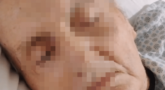 Situação De Paciente Internado Na Unimed São Roque Termina Na Delegacia Com Denuncia Grave