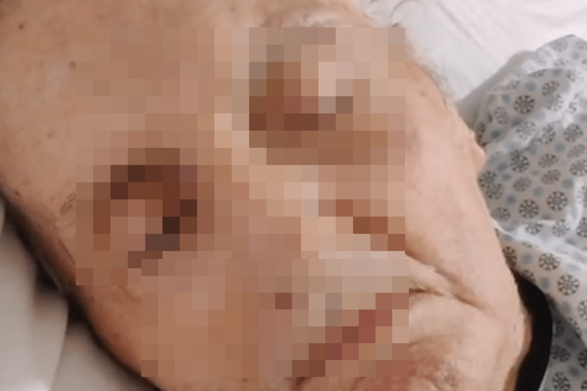 Situação De Paciente Internado Na Unimed São Roque Termina Na Delegacia Com Denuncia Grave