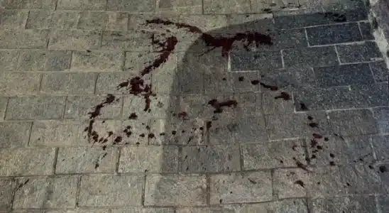 Cadela Rottweiler Morta A Tiros Por Vizinho Em So 1777140274867