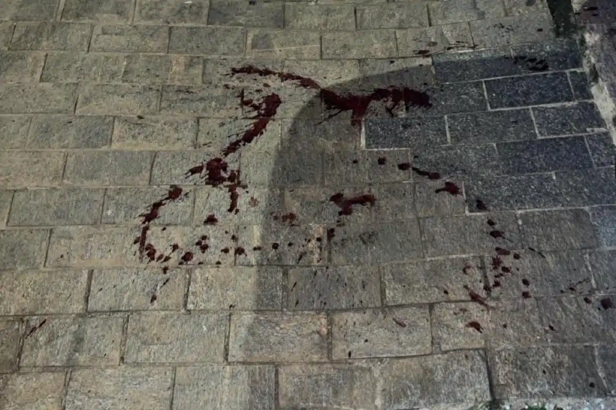 Cadela Rottweiler Morta A Tiros Por Vizinho Em So 1777140274867