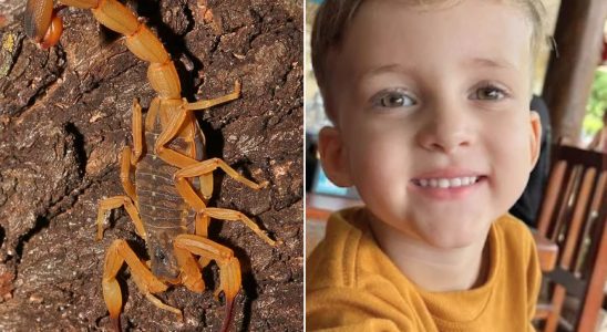 Morte De Criana Por Picada De Escorpio Expe Fragil 1775164859183